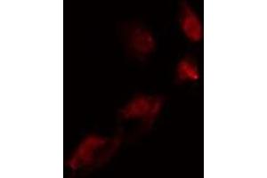 ABIN6275542 staining  COLO205 cells by IF/ICC.