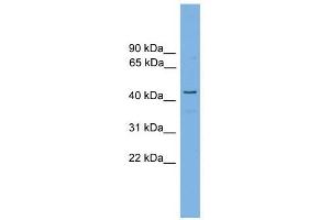RDH16 antibody used at 1 ug/ml to detect target protein. (RDH16 antibody)
