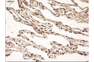 Image no. 6 for anti-Myc Proto-Oncogene protein (MYC) antibody (ABIN1497011) (c-MYC antibody)