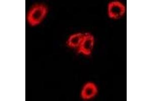 Immunofluorescent analysis of OXA1L staining in U2OS cells.