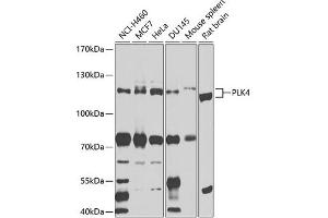 Western blot analysis of extracts of various cell lines, using PLK4 antibody (ABIN6132496, ABIN6145781, ABIN6145782 and ABIN6225196) at 1:1000 dilution. (PLK4 antibody  (AA 641-970))