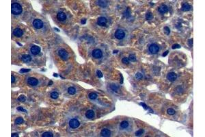DAB staining on IHC-P; Samples: Rat Liver Tissue (LSS antibody  (AA 101-250))