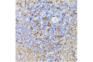 IHC Analysis using ABIN6140687 (FLT1 antibody  (AA 20-300))