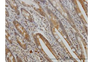 Immunoperoxidase of monoclonal antibody to GMPS on formalin-fixed paraffin-embedded human small Intestine. (GMP Synthase antibody  (AA 108-215))