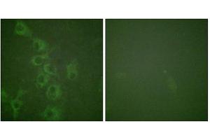 Immunofluorescence analysis of HuvEc cells, using Histamine H1 Receptor (Phospho-Ser398) antibody. (HRH1 antibody  (pSer398))