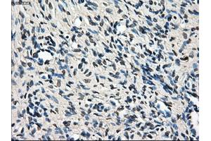 Immunohistochemical staining of paraffin-embedded colon tissue using anti-LEMD3mouse monoclonal antibody. (LEMD3 antibody)