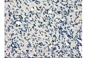 Immunohistochemical staining of paraffin-embedded colon tissue using anti-LEMD3mouse monoclonal antibody.