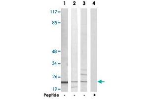 Western blot analysis of extracts from Jurkat cells (Lane 1 and lane 4), K-562 cells (Lane 2) and HUVEC cells (Lane 3), using AKAP14 polyclonal antibody .