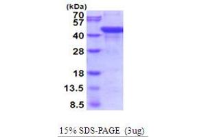 SDS-PAGE (SDS) image for Aspartylglucosaminidase (AGA) (AA 24-346) protein (His tag) (ABIN5854092) (AGA Protein (AA 24-346) (His tag))