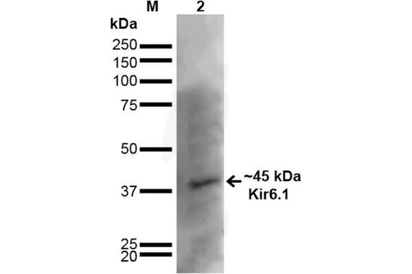 KCNJ8 Antikörper  (AA 306-424)