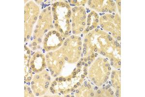 Immunohistochemistry (IHC) image for anti-Insulin-Degrading Enzyme (IDE) (AA 1-250) antibody (ABIN1513057) (IDE antibody  (AA 1-250))