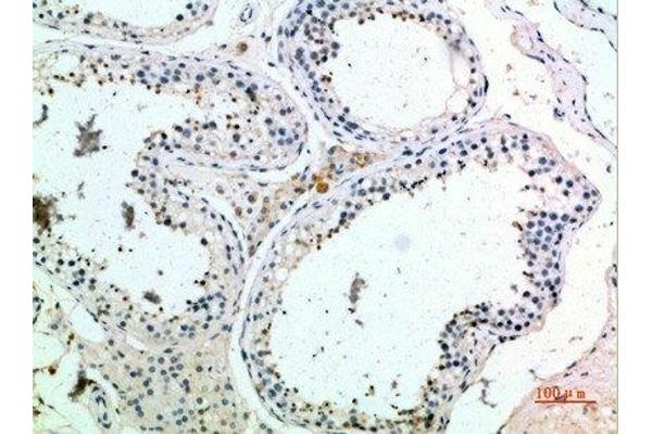 PMCH antibody  (AA 112-161)