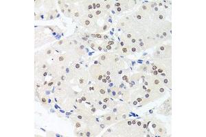 Immunohistochemistry of paraffin-embedded human stomach using HMGN1 antibody. (HMGN1 antibody  (AA 1-100))