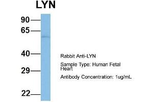 Host: Rabbit  Target Name: LYN  Sample Tissue: Human Fetal Heart  Antibody Dilution: 1. (LYN antibody  (N-Term))