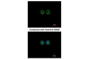 ICC/IF Image Immunofluorescence analysis of methanol-fixed A549, using RAGE, antibody at 1:100 dilution. (MOK antibody)