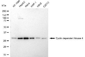 Western blotting analysis using Cyclin dependent kinase 4 antibody (ABIN7798215).