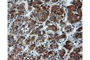 Image no. 5 for anti-Lipase, Endothelial (LIPG) antibody (ABIN1499162)