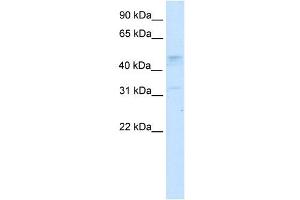 Western Blot showing TCFAP2C antibody used at a concentration of 1-2 ug/ml to detect its target protein. (TFAP2C antibody  (N-Term))