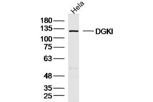 Hela lysates probed with DGKI Polyclonal Antibody, Unconjugated  at 1:300 dilution and 4˚C overnight incubation. (DGKI antibody  (AA 101-200))