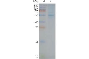 Human ST-Nanodisc, Flag Tag on SDS-PAGE (STEAP2 Protein)