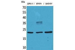 Western Blotting (WB) image for anti-Fibroblast Growth Factor 12 (FGF12) (Internal Region) antibody (ABIN3187704) (FGF12 antibody  (Internal Region))