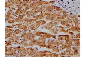 IHC image of ABIN7127627 diluted at 1:100 and staining in paraffin-embedded human liver tissue performed on a Leica BondTM system. (Recombinant Monoamine Oxidase A antibody)