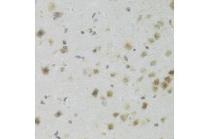 Immunohistochemistry of paraffin-embedded mouse brain using PAWR Antibody (ABIN5971565) at dilution of 1/100 (40x lens). (PAWR antibody)