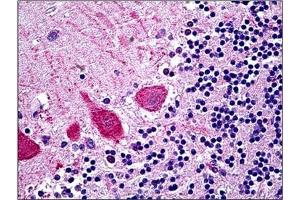 Human Brain Cerebellum: Formalin-Fixed, Paraffin-Embedded (FFPE). (TRIM71 antibody  (AA 390-402))