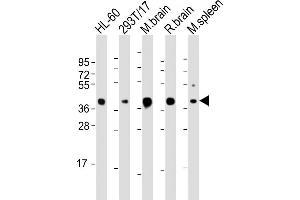 ALDOC Antibody (C-term) (ABIN1882192 and ABIN2843477) western blot analysis in HL-60,293 cell line and mouse brain,spleen lysates (35 μg/lane). (ALDOC antibody)