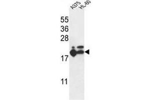 RPL17 Antibody (C-term) western blot analysis in A375,HL-60 cell line lysates (35µg/lane).
