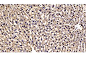 Immunohistochemistry (IHC) image for anti-Notch 2 N-terminal Like (NOTCH2NL) (AA 1-236) antibody (ABIN7430273)