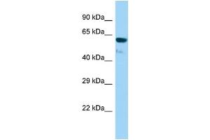 Host: Rabbit Target Name: Gtf3c5 Sample Type: Rat Stomach lysates Antibody Dilution: 1. (GTF3C5 antibody  (Middle Region))