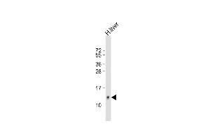 Anti-HP Antibody (Center) at 1:500 dilution + human liver lysate Lysates/proteins at 20 μg per lane. (Hepcidin antibody  (AA 17-46))