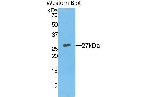 Detection of Recombinant KLK3, Mouse using Polyclonal Antibody to Prostate Specific Antigen (PSA)