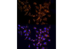 Immunofluorescence analysis of C6 cells using RPL10A Rabbit pAb (ABIN6129099, ABIN6147103, ABIN6147104 and ABIN6221624) at dilution of 1:100 (40x lens). (RPL10A antibody  (AA 1-110))