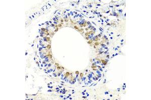 Immunohistochemistry of paraffin-embedded mouse lung using ENDOG antibody. (Endonuclease G antibody)