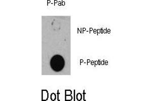 Image no. 1 for anti-Tuberous Sclerosis 1 (TSC1) (pSer505) antibody (ABIN358402) (TSC1 antibody  (pSer505))