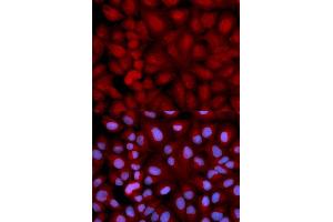 Immunofluorescence (IF) image for anti-Synuclein, gamma (Breast Cancer-Specific Protein 1) (SNCG) antibody (ABIN1874888) (SNCG antibody)