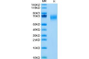 Cynomolgus IL-1 Rrp2/IL-1 R6 on Tris-Bis PAGE under reduced condition. (IL1RL2 Protein (AA 20-335) (His tag))