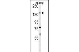ATP11C Antibody (Center) (ABIN651638 and ABIN2840341) western blot analysis in mouse lung tissue lysates (35 μg/lane).