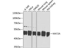 Western blot analysis of extracts of various cell lines, using MA antibody (ABIN6132330, ABIN6143574, ABIN6143575 and ABIN6224497) at 1:1000 dilution. (MAT2A antibody  (AA 1-395))