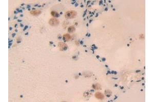 Immunohistochemistry (IHC) image for anti-RAR-Related Orphan Receptor C (RORC) (AA 212-461) antibody (ABIN7439402)