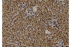 ABIN6260754 and ABIN6273457 at 1/100 staining Mouse kidney tissue by IHC-P.
