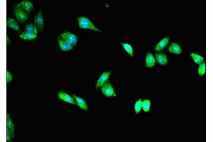 Immunofluorescent analysis of HepG2 cells using ABIN7172803 at dilution of 1:100 and Alexa Fluor 488-congugated AffiniPure Goat Anti-Rabbit IgG(H+L) (TACC3 antibody  (AA 133-268))