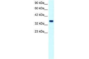 WB Suggested Anti-FOXF1 Antibody Titration:  2. (FOXF1 antibody  (C-Term))