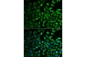 Immunofluorescence analysis of A549 cell using IMPA1 antibody. (IMPA1 antibody)