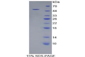 SDS-PAGE analysis of Human PSMC2 Protein.