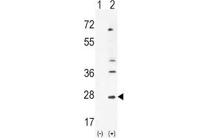 Western Blotting (WB) image for anti-Leukemia Inhibitory Factor (LIF) antibody (ABIN3002910)