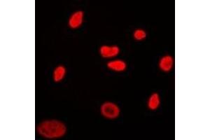 Immunofluorescent analysis of CABLES2 staining in Hela cells. (CABLES2 antibody)