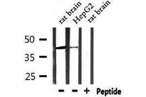 Western blot analysis of extracts from HepG2 and rat brain, using CCR3 Antibody. (CCR3 antibody  (C-Term))